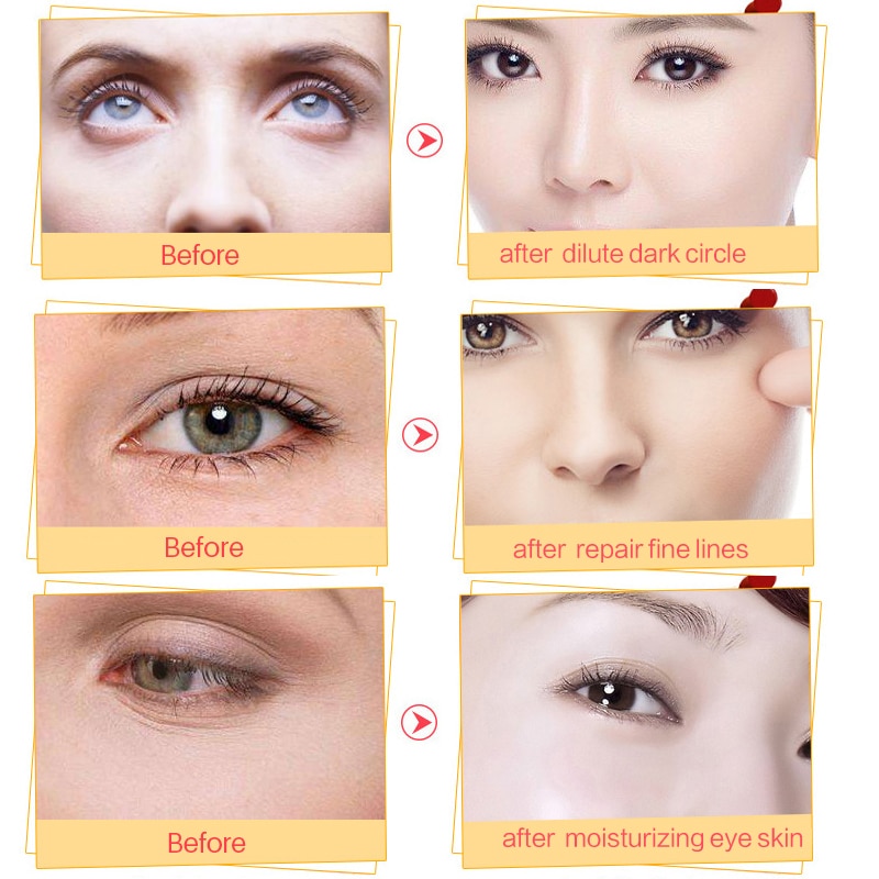 Gold Crystal Collagen Eye Patches 10 pcs/Set